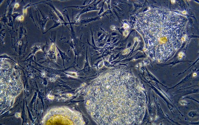 Vaccinul împotriva gripei porcine este cancerigen?