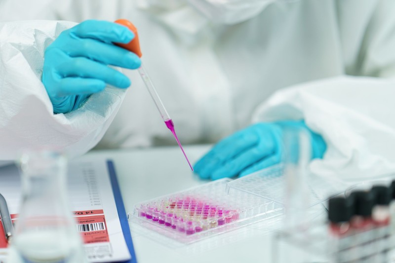 Testele pentru depistarea anticorpilor sunt mai ieftine decât analiza RT-PCR
