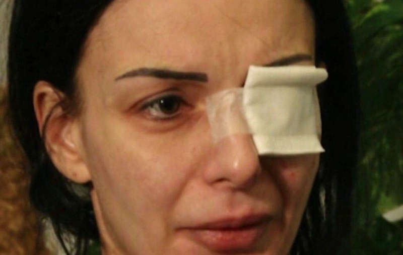 Mărturiile cutremurătoare, făcute de Alina, românca atacată cu acid în Italia. "M-am gândit numai la fiul meu"