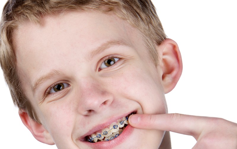 Copilul tău are nevoie de aparat dentar? Află la ce vârstă şi în ce situaţii trebuie să te gândeşti la această soluţie