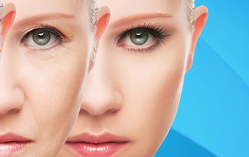 Scapa de riduri folosind revolutionara crema Bioxelan! Afla care este secretul acestui tratament natural!