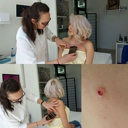 Raluca de la Bambi a ajuns pe mâna medicului. "Pot cauza probleme grave"