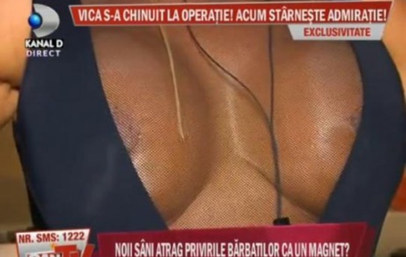 Vica Blochina şi-a arătat silicoanele: "Mi-au ieşit perfect!" Tu ce părere ai?
