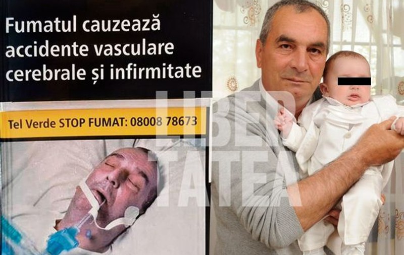 UPDATE: Primele fotografii cu românul a cărui poză ar fi fost folosită abuziv pe pachetele de țigări. ”Persoana nu a fost operată la Institutul Inimii din Cluj”