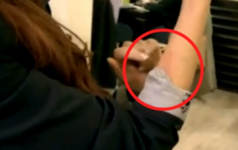 Bianca, APARIŢIE ŞOCANTĂ la finala MasterChef, CU O ARSURĂ IMENSĂ PE MÂNĂ! Uite ce spune că a păţit