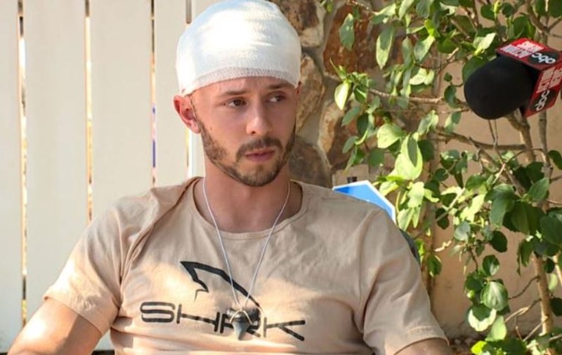 Un american a fost mușcat de cap de un aligator, în timp ce făcea scufundări. „Se mișca extrem de repede”
