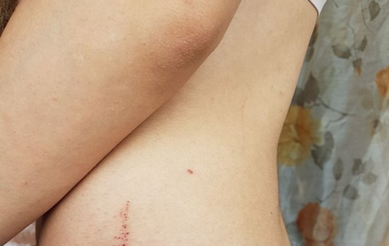 Fosta concurentă de la Vocea României, zdrobită în bătaie de soț. Detalii cutremurătoare au ieșit la iveală