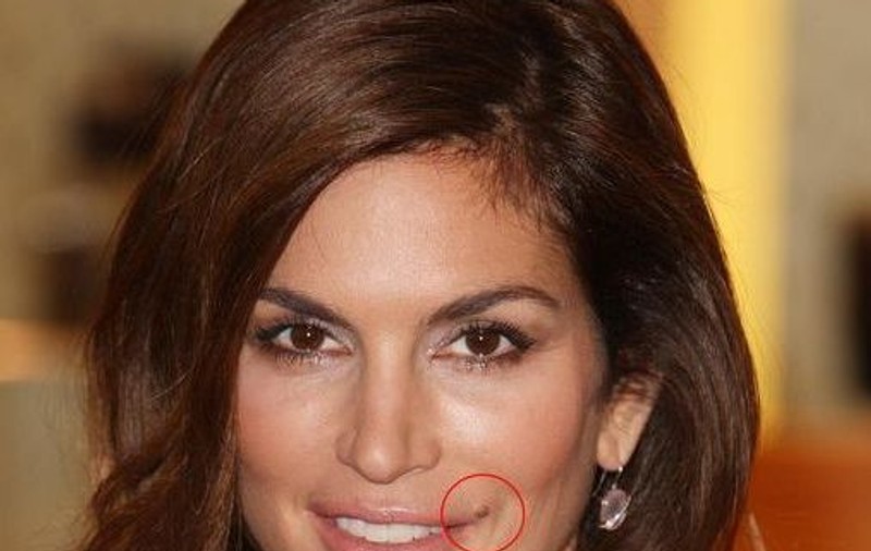 Cindy Crawford se teme ca aluniţa ei să nu fie cancerigenă