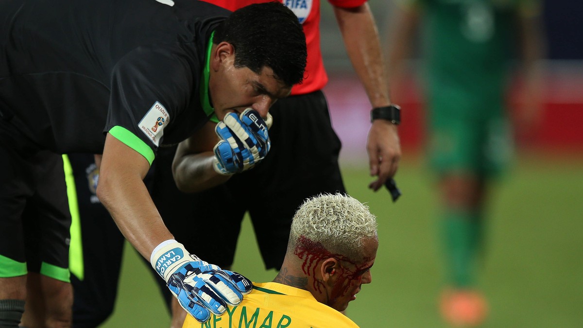 Brazilianul Neymar, cu fața plină de sânge, arată precum un luptător în cușcă