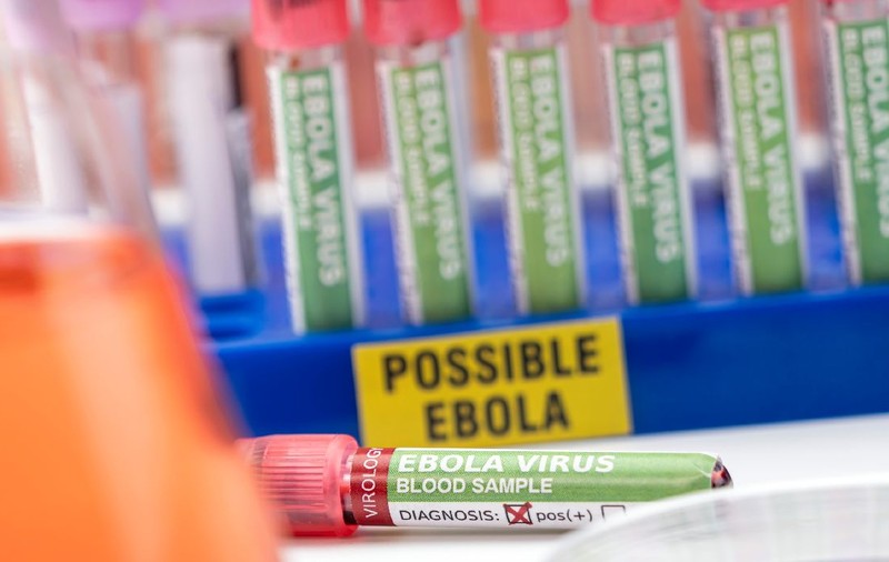 Epidemia de Ebola în 2026: Peste 2.700 de morți în Congo. Avertismentul prof. dr. Cristian Apetrei: „Numărul real de cazuri ar putea fi între 10.000 și 15.000. Epidemia este o problemă globală”