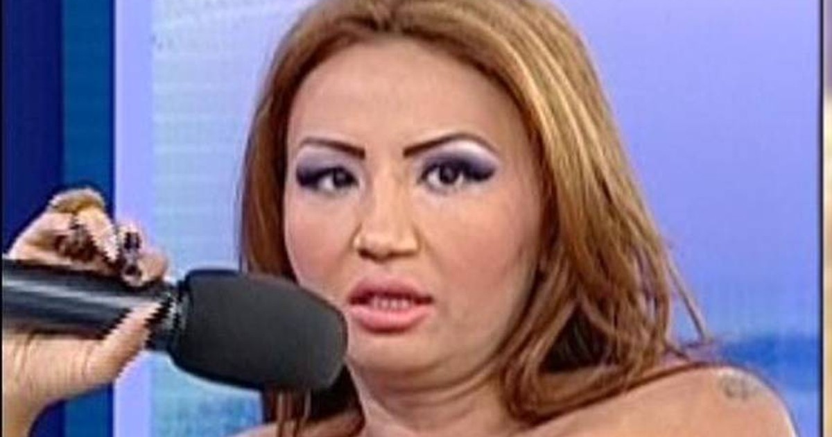Foto