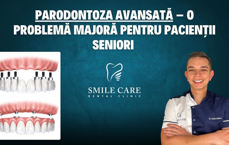 Studiu SMILE CARE: Parodontoza avansată – o problemă majoră pentru pacienții seniori 