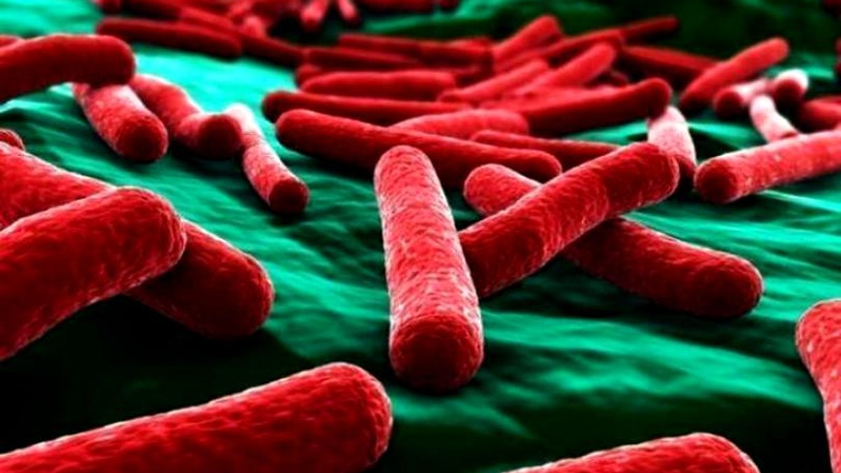 Lista cu alimentele cu suspiciune de contaminare cu Listeria