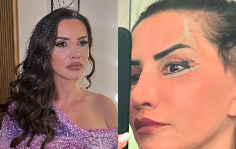 Mara Bănică, o nouă intervenție estetică la față: „A durat o oră și jumătate și a costat 3.200 de euro”. Ce procedură și-a făcut