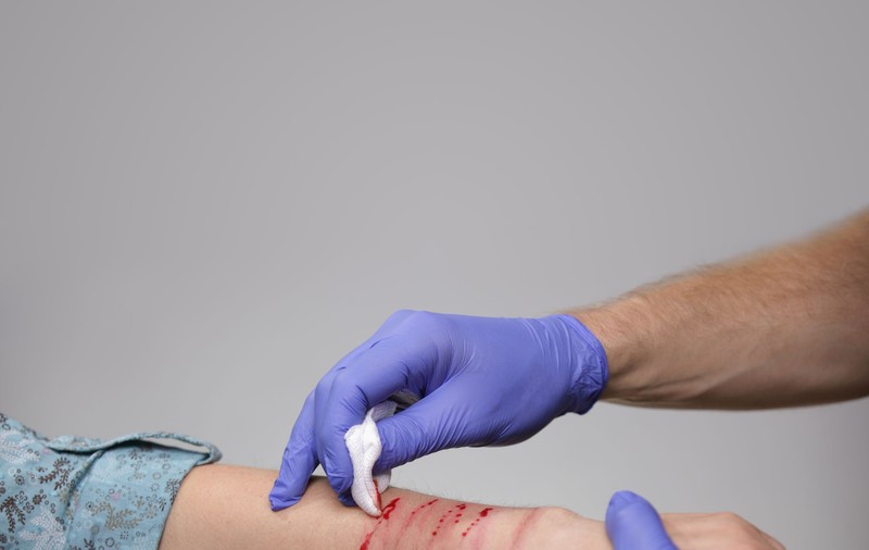 A fost creat adezivul chirurgical care închide orice rană în câteva secunde