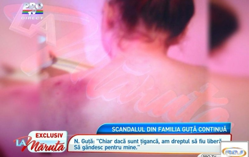 Nicoleta Guţă a prezentat dovezile că tatăl ei A BĂTUT-O. Uite cum arata manelista după o BĂTAIE SORĂ cu MOARTEA!