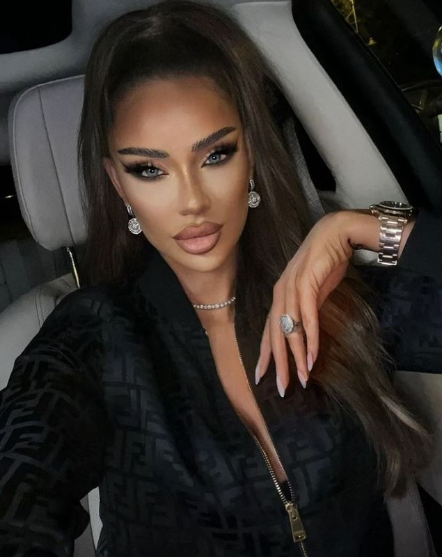 Bianca Drăgușanu și-a topit acidul hialuronic din buze: „Fața mea a fost stricată. M-am injectat vreo 20 de ani mult și prost”