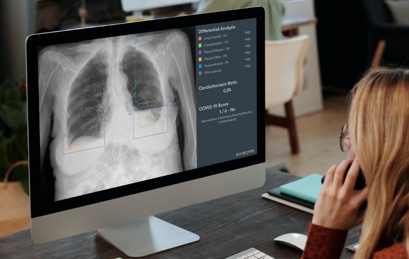 Medicii MedLife atrag atenția asupra importanței investigațiilor imagistice în diagnosticarea cancerului pulmonar și explică rolul inteligenței artificiale în acest proces