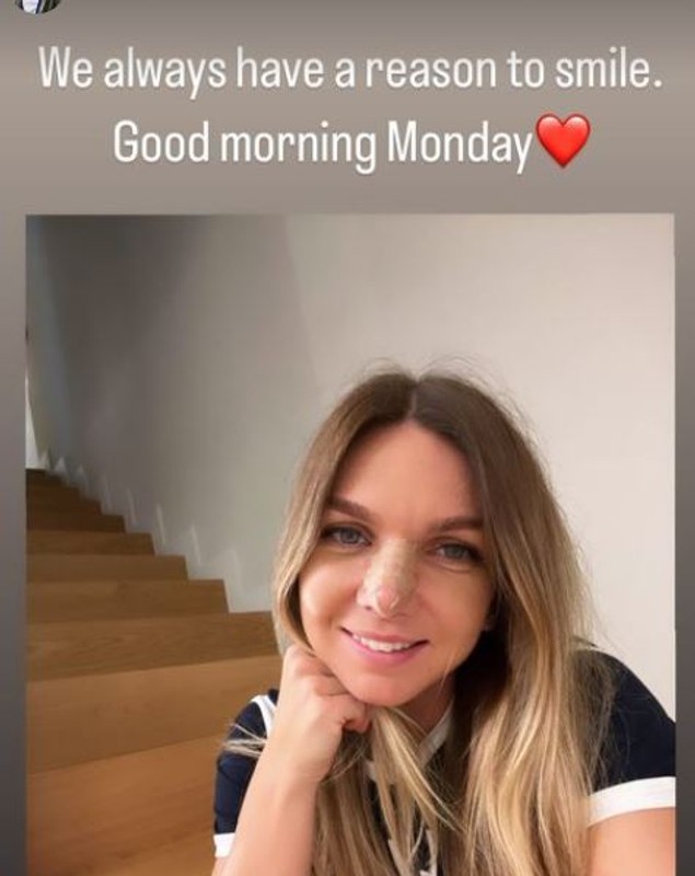 Cum arată Simona Halep la o săptămână de la operația la nas: „Mereu avem un motiv să zâmbim”
