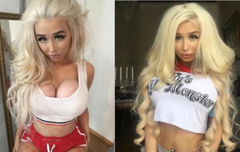 O tânără de 21 de ani vrea să devină o păpușă Barbie. Era să moară după ce și-a pus sâni de mărimea pepenilor, dar nu renunță la visul ei. Uite cum arată | FOTO