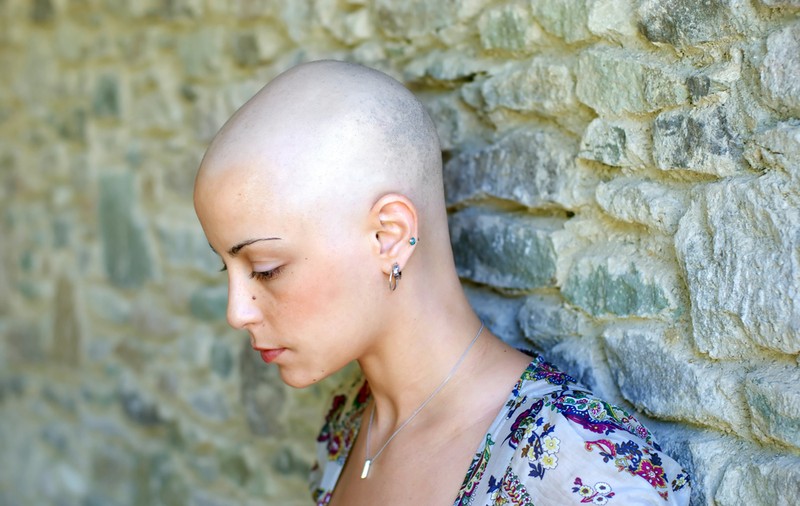 Cum știi că ai cancer: Află simptomele generale ale acestei boli