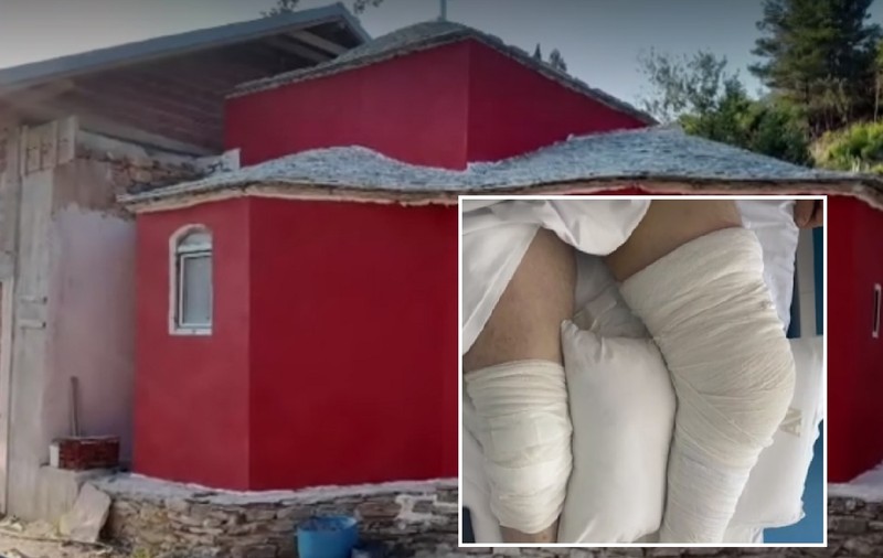 Un român a fost împușcat în ambele picioare de un preot, tot român, de la Muntele Athos: „S-a dus la centrală, a luat arma de vânătoare, am auzit poc!”