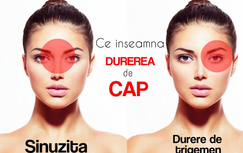 CE BOALĂ AI, ÎN FUNCŢIE DE CUM TE DOARE CAPUL