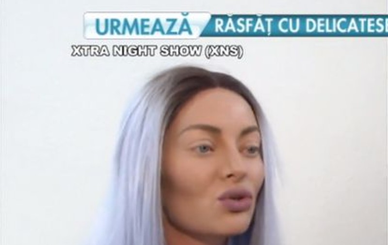 Delia cântă la cârjă în cea de a zecea ediție iUmor. Nimeni nu se aștepta la așa ceva | FOTO