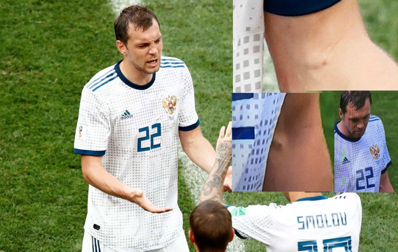 Ce este cu înțepăturile de pe brațul fotbalistului rus Dziuba. Echipa lui Stanislav Cercesov, sfertfinalistă la Campionatul Mondial de fotbal Rusia 2018, din nou acuzată