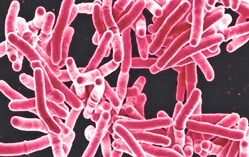 Tuberculoza ucide tot mai mulţi oameni