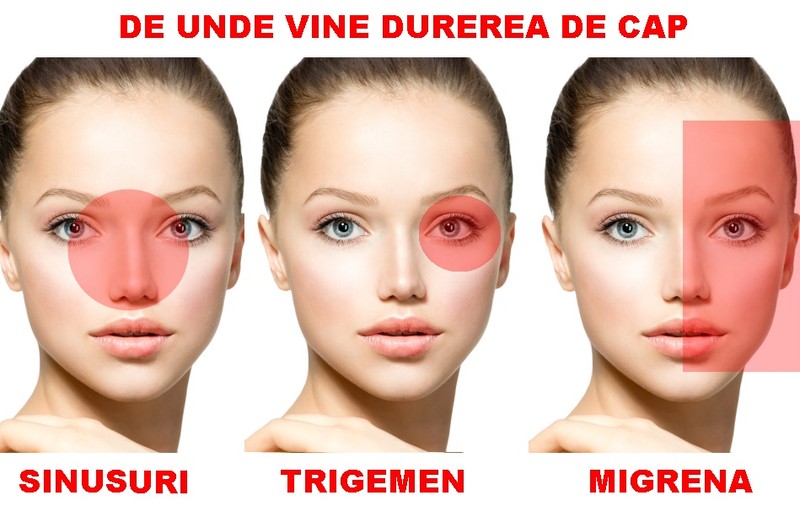 Ce boală ai, în funcţie de cum te doare capul