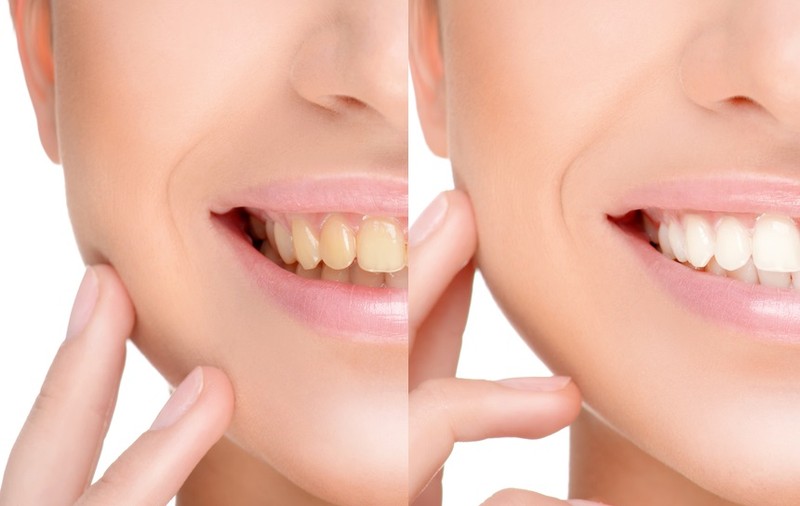 Vrei să ai dinți mai sănătoși? Află ce înseamna ”oil-pulling” și cum se face