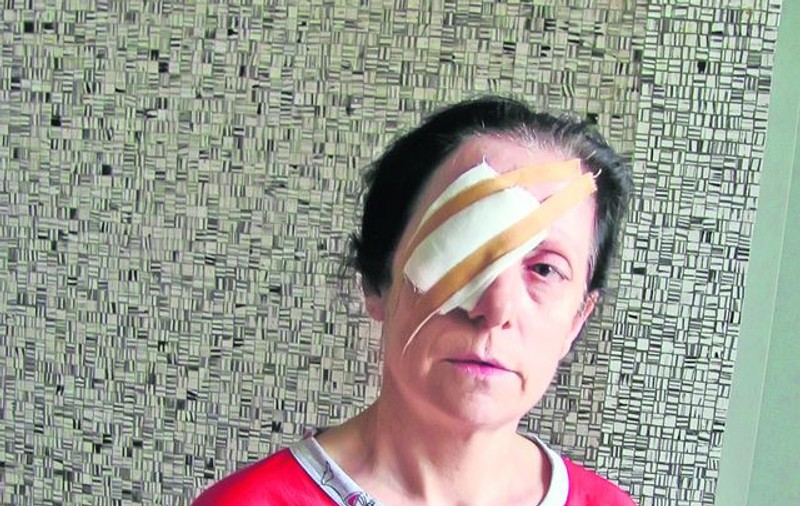O asistentă din Galaţi a scăpat cu viaţă, însă a fost desfigurată de propriul soţ: «Mi-a aruncat cu acid pe faţă pentru că am vrut să divorţez»