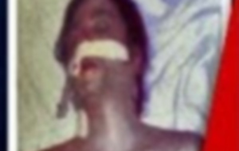 Noi imagini ŞOCANTE de la AUTOPSIA lui Michael Jackson