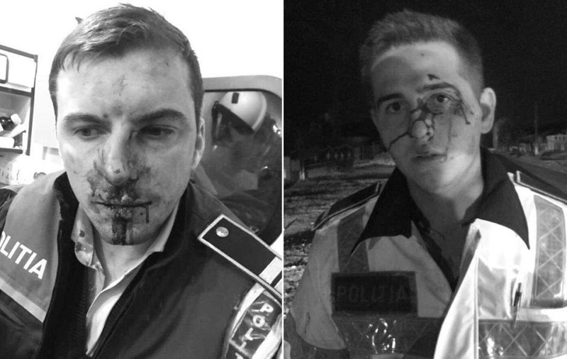 Precizările MAI în cazul polițiștilor bătuți și lăsați fără arme în Vâlcea. Unul dintre agenții agresați, transferat în București pentru a fi operat