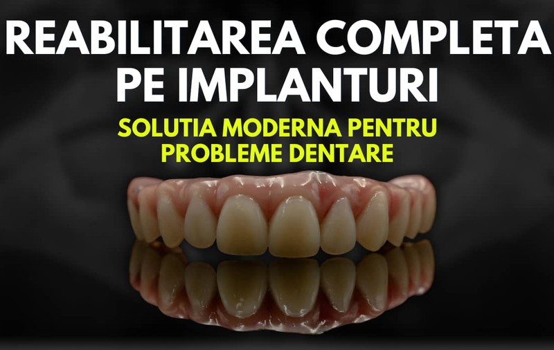 O Soluţie Modernă pentru Probleme Dentare: Reabilitarea Completă cu Implanturi