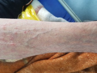 Ion şi Dima au bubiţe roşii pe piele. Ei cred că de la mâncare