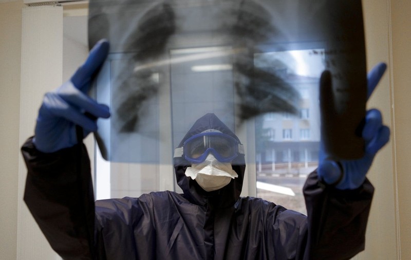 Premieră mondială: Transplant la plămâni pentru un pacient grav afectat de Covid-19 de la donatori în viață