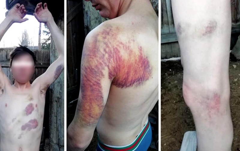 Șeful de post acuzat că a stâlcit în bătaie un tânăr chiar în secția de poliție, cercetat disciplinar și mutat în altă comună. „Nu-l mai vrem aici!”
