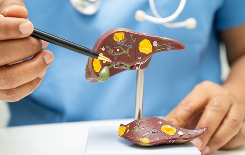 Avertismentul medicilor: Ficatul gras îmbolnăvește inima. Campania care explică de ce steatoza nu este un diagnostic banal