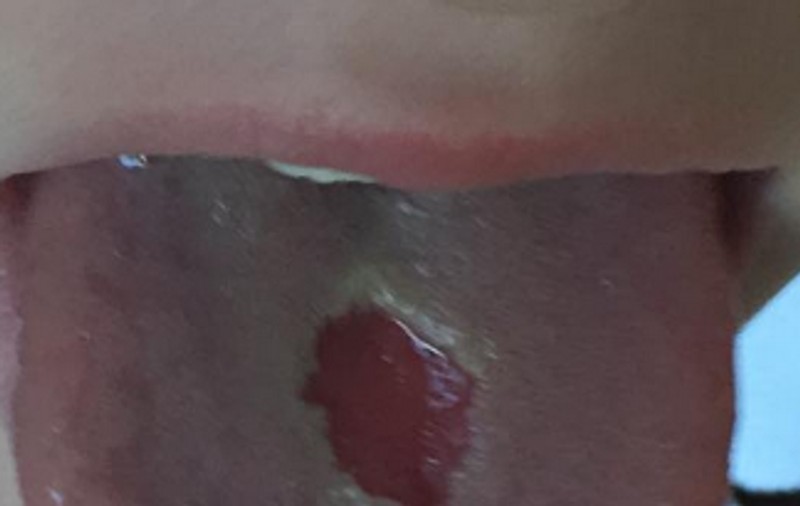 CAZ ȘOCANT! Un băiețel și-a ars LIMBA CU BOMBOANE! Mama COPILULUI declară RĂZBOI PRODUCĂTORULUI