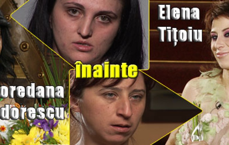 "Frumuseţe pe muchie de cuţit" a rezolvat complexele din copilărie a două femei