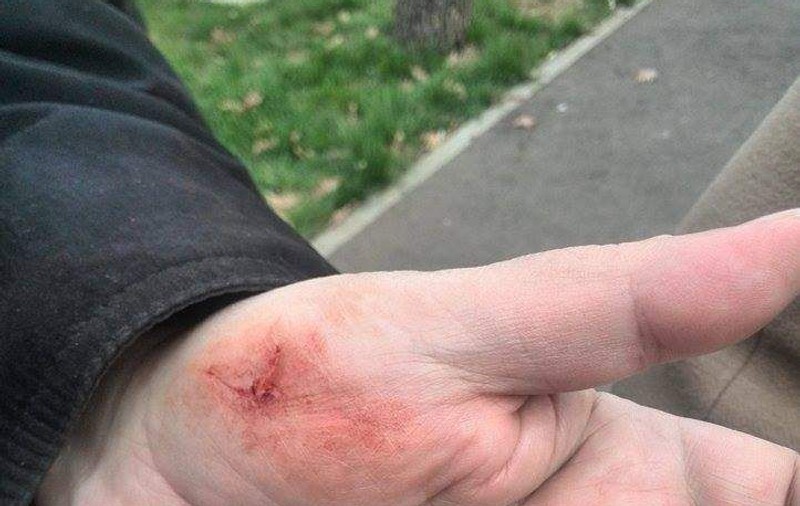 Luis Suarez nu e singurul "canibal" din fotbal. Alt jucător şi-a muşcat adversarul!