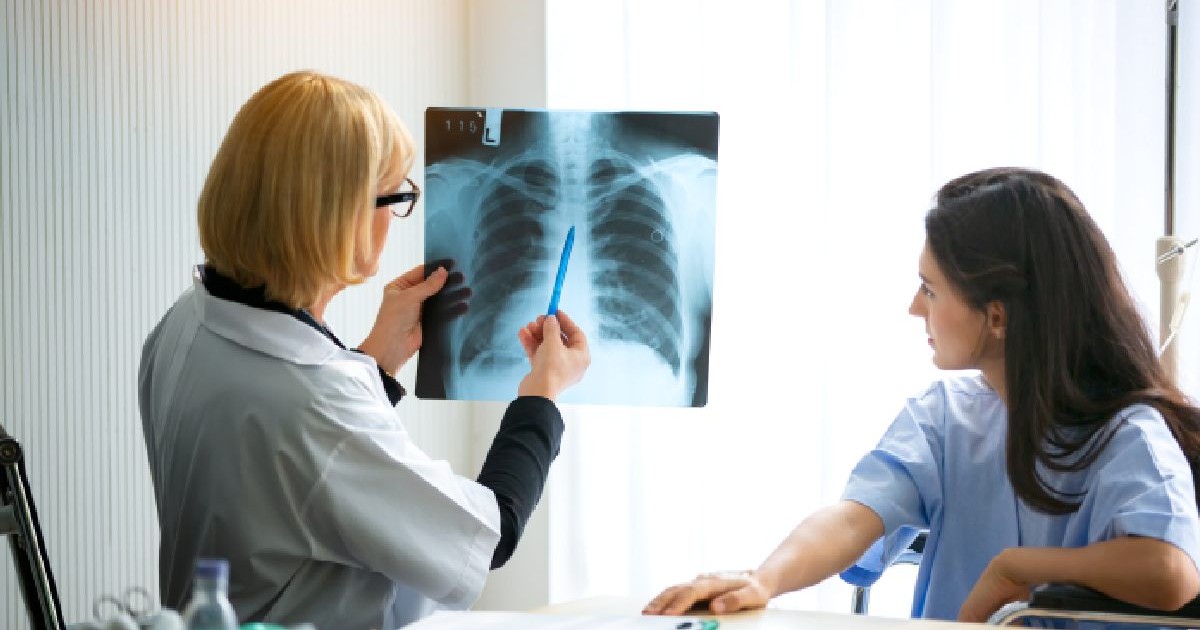 Intr-un cabinet un medic femeie in halat alb priveste o radiografie pulmonara si o alta femeie priveste. Cancer pulmonar, nefumatori, poluare