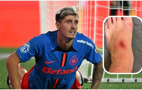 David Miculescu, out în derby-ul cu U Craiova? Cum arată piciorul căpitanului FCSB după accidentarea din meciul cu Petrolul