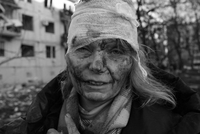O femeie rănită în fața unui un bloc lovit de bombardamentul rusesc în Ciuhuiiv, lângă orașul Harkov FOTO: Hepta