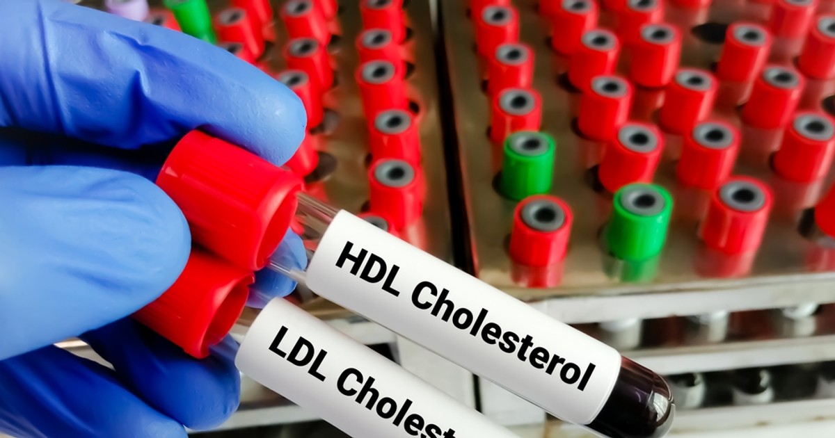 Alimente care ajută la scăderea colesterolului - Imagine cu un stativ de eprubete cu sânge, din care au fost scose două, pe care scrie HDL Cholesterol şi LDL Cholesterol.