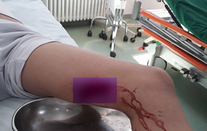 Un copil s-a rănit la un loc de joacă dezafectat, dintr-un parc din Buzău. Tatăl băiatului cere socoteală Primăriei/ FOTO