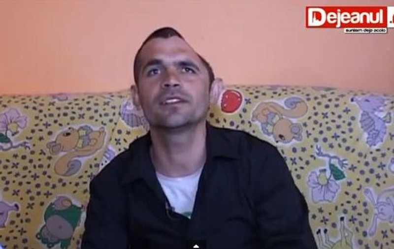 Povestea românului care A TRĂIT cu O JUMĂTATE de CRANIU. Doar o bucată de piele îi mai proteja creierul! | VIDEO