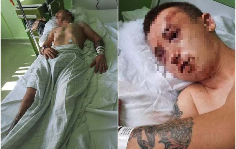 Tânăr bătut, tâlhărit și lăsat inconștient pe un trotuar, în Arad. Agresorii, cercetați în stare de libertate